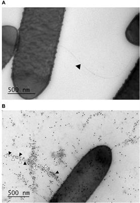 A Comparative Characterization of Different Host-sourced Lactobacillus ruminis Strains and Their Adhesive, Inhibitory, and Immunomodulating Functions